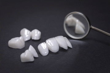 بررسی علت تفاوت قیمت کامپوزیت دندان