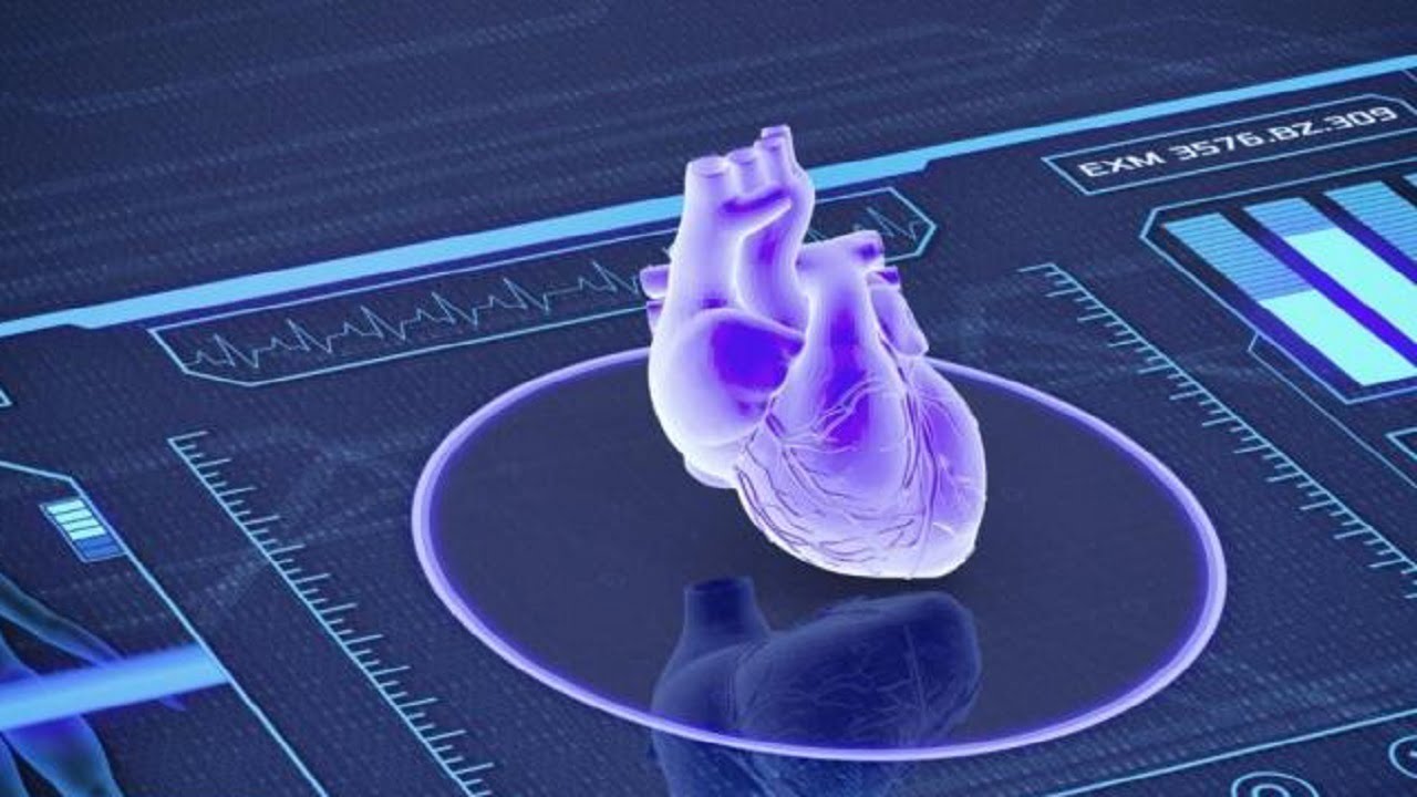 پیش‌بینی حمله قلبی با بررسی عکس رادیولوژی
