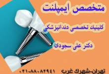 متخصص ایمپلنت کیست و چه ویژگی هایی دارد؟