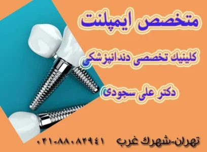 متخصص ایمپلنت کیست و چه ویژگی هایی دارد؟