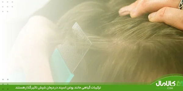 شامپو سبغ برای ریزش مو خوبه؟