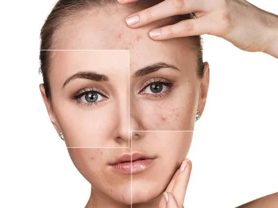 قرص گلوتاتیون حاوی آنتی اکسیدانی مفید و ضروری