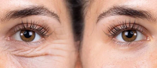  روش صحیح استفاده از کرم‌های دور چشم