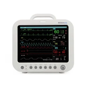 What parameters does the patient monitor show?