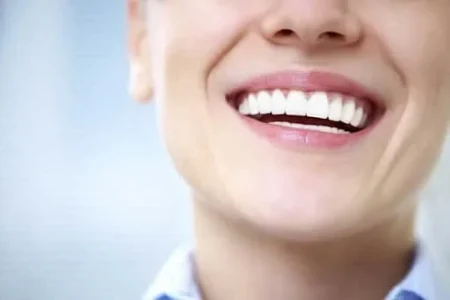 نحوه گذاشتن کامپوزیت