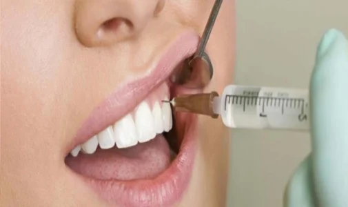 کامپوزیت برای دندان ضرر دارد؟