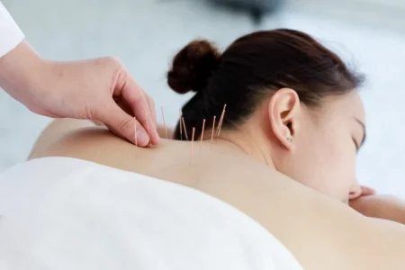 لاغری و طب سوزنی
