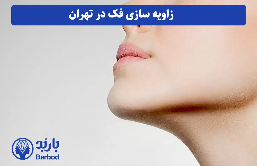 زاویه سازی فک در تهران