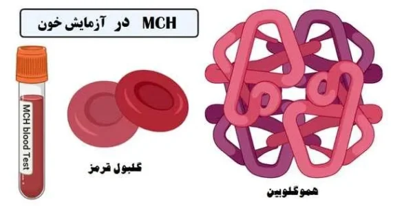 پایین بودن mchc در آزمایش خون نشانه چیست؟