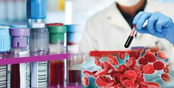 پایین بودن mchc در آزمایش خون نشانه چیست؟ پایین بودن mchc در آزمایش خون نشانه چیست؟