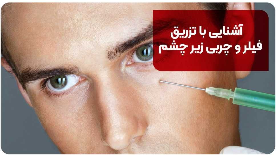 آشنایی با تزریق فیلر و چربی زیر چشم