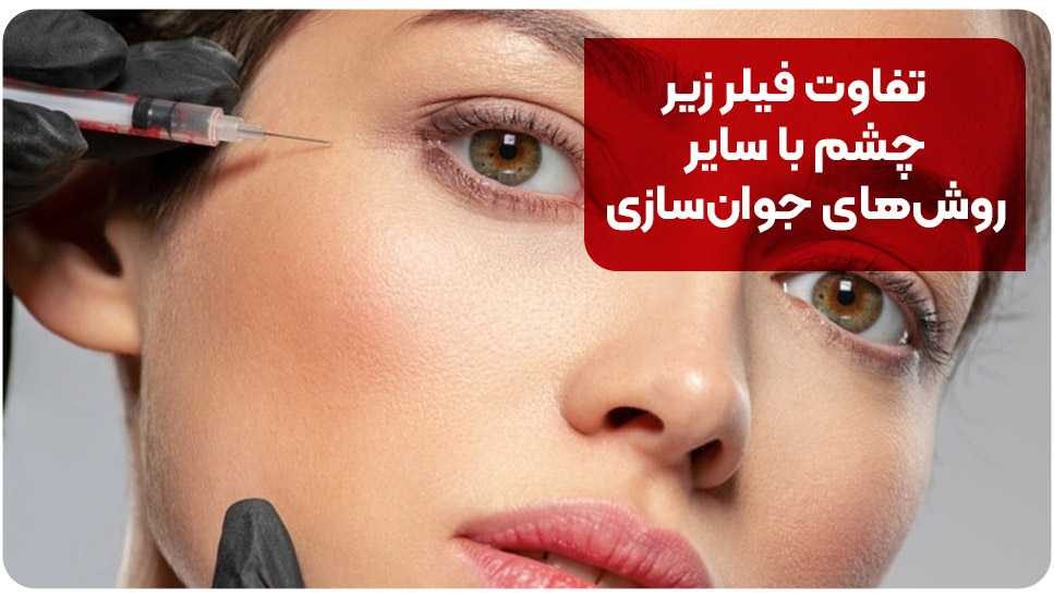 تفاوت فیلر زیر چشم با سایر روش های جوان سازی