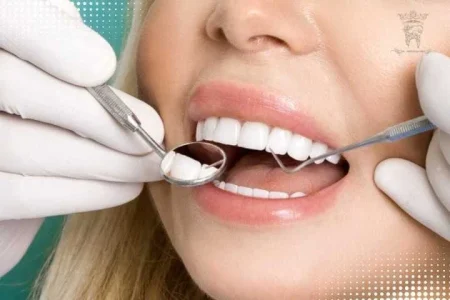 لمینت دندان سه روزه: بهبود سریع، مطمئن و باکیفیت لبخند با دکتر عبدالصمدی