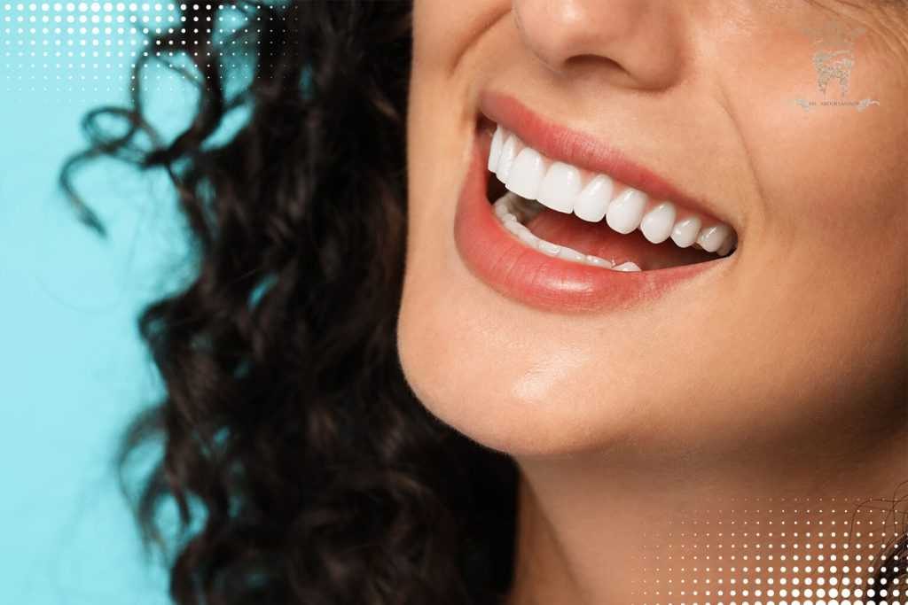 لمینت دندان سه روزه: بهبود سریع، مطمئن و باکیفیت لبخند با دکتر عبدالصمدی