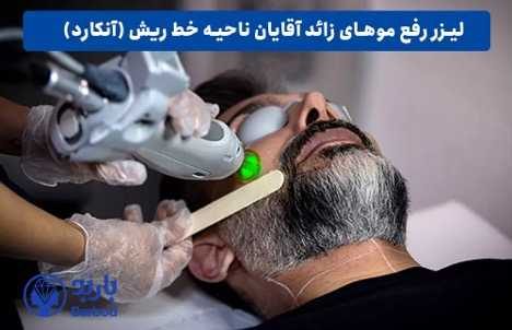مزایای لیزر موهای زائد آقایان: از پوستی صاف تا کاهش تعریق