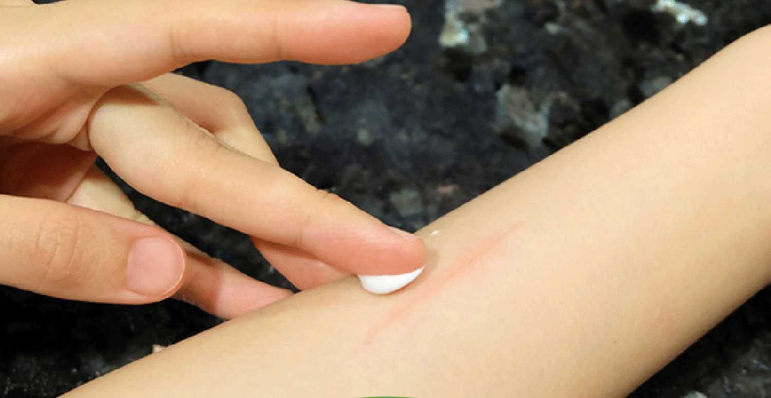 بهترین زمان استفاده از کرم های ترمیم کننده برای نتایج بهتر بهترین زمان استفاده از کرم های ترمیم کننده برای نتایج بهتر