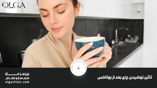 بعد از بوتاکس کی غذا بخوریم؟